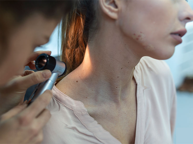  A dermatologist checking a patient's skin