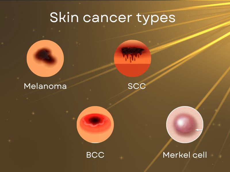 type of skin cancer