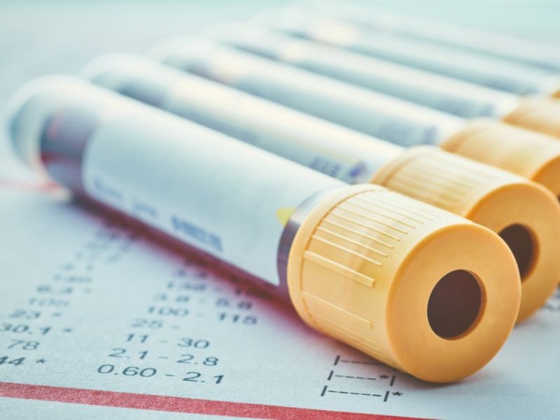 Blood tests for Folliculitis diagnosis