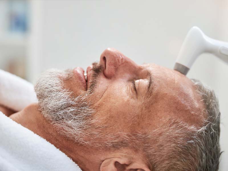 Microdermabrasion treats Sebaceous Hyperplasia
