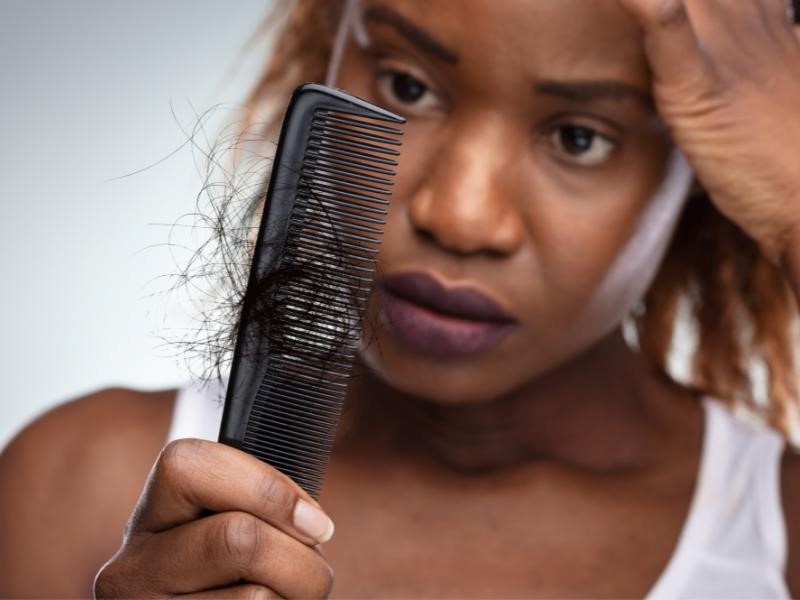 Chronic Telogen Effluvium Hair loss