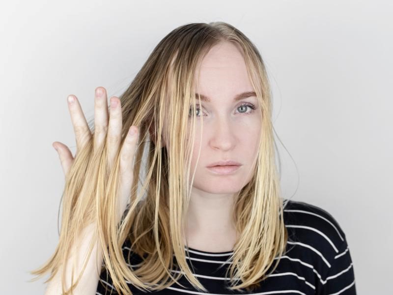 Thin hair Telogen Effluvium symptom