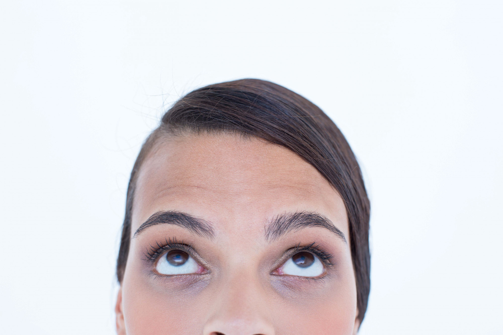 Androgenic Alopecia in Women