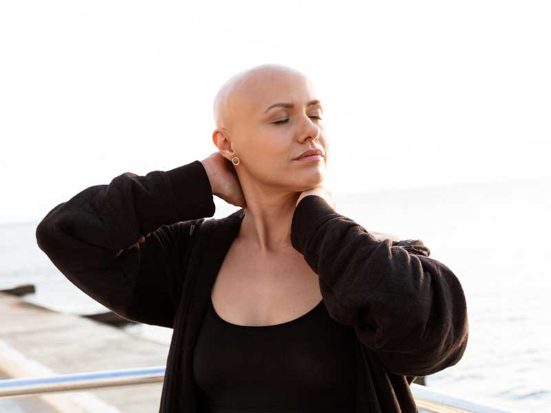 Woman with Anagen Effluvium