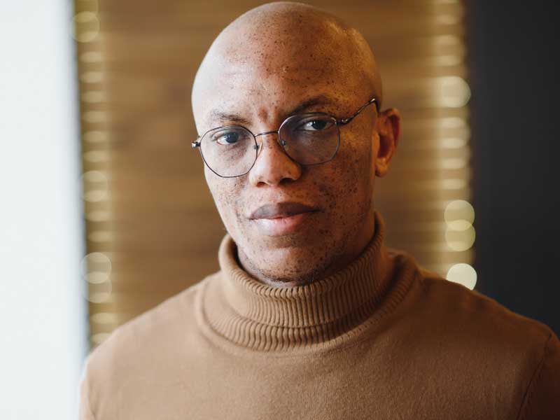 Man with Anagen Effluvium Symptom