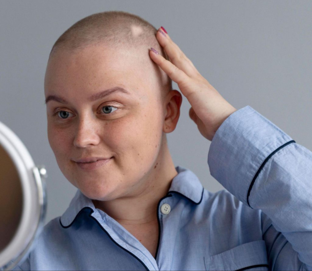 Spot baldness in Women