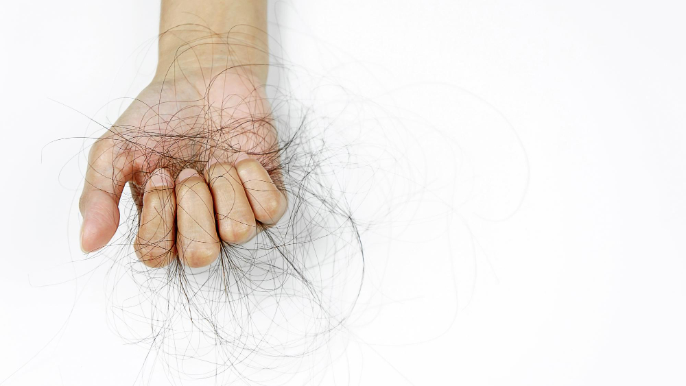Trichotillomania, hair pulling disorder Symptoms