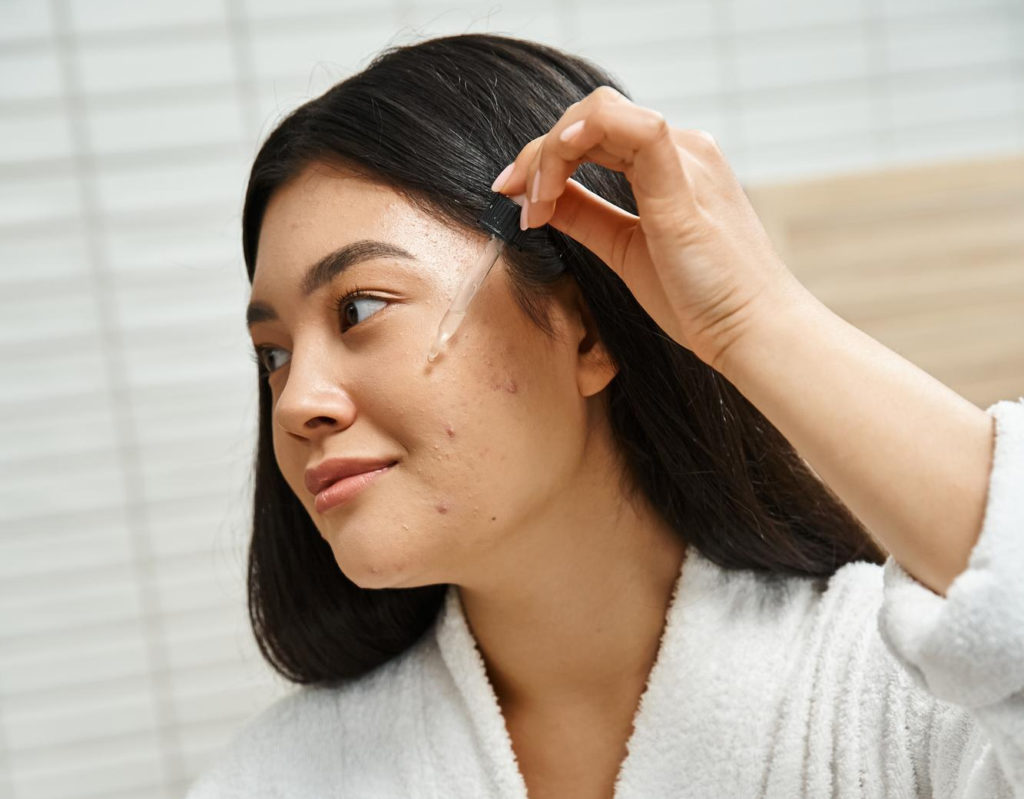 Colloidal Silver for Acne