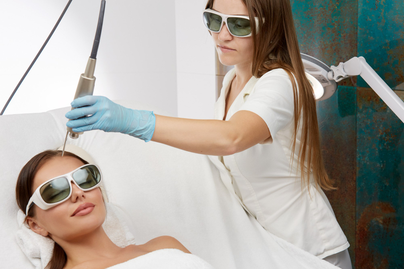 rosacea laser treatment how works