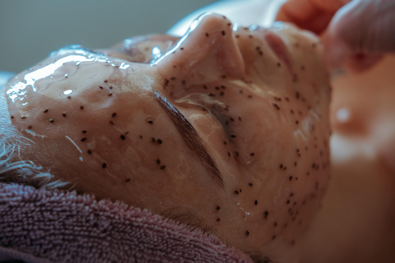 Chemical peels Sebaceous filaments treatment