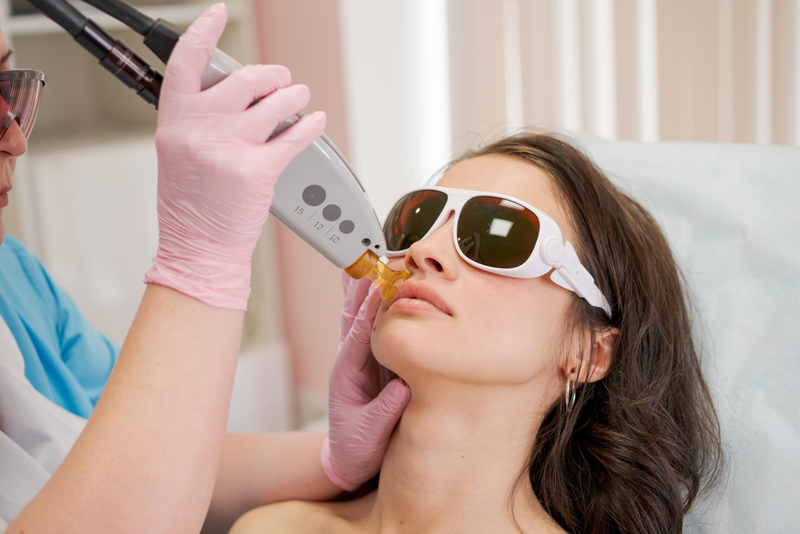 Laser Facial Hair Removal