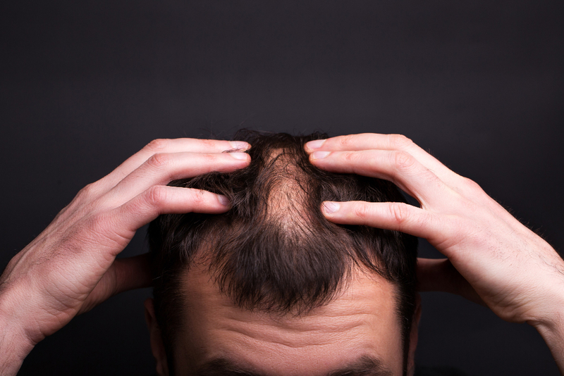 Relationship between alopecia and stress