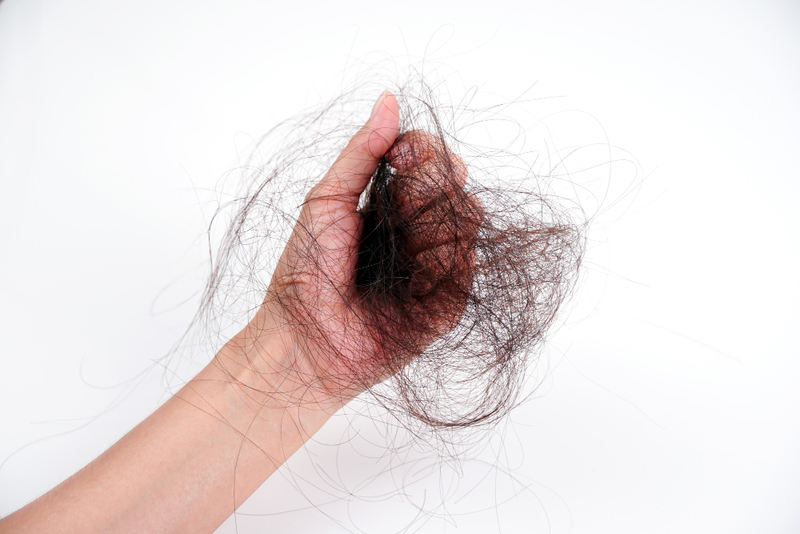 hair loss and stress relation
