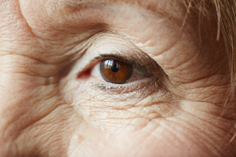 how to reduce eye wrinkles